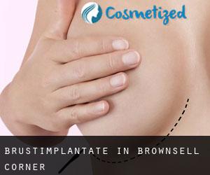 Brustimplantate in Brownsell Corner