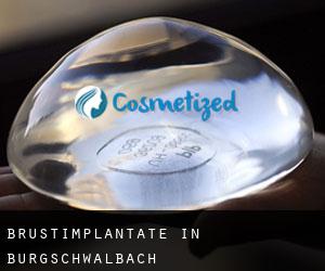 Brustimplantate in Burgschwalbach