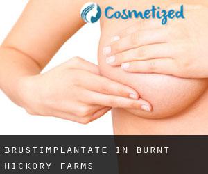 Brustimplantate in Burnt Hickory Farms