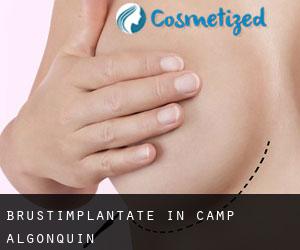 Brustimplantate in Camp Algonquin
