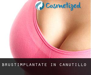Brustimplantate in Canutillo