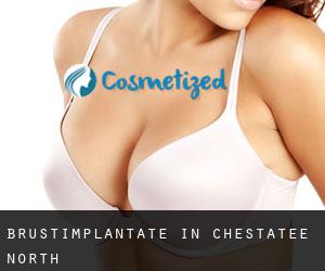 Brustimplantate in Chestatee North