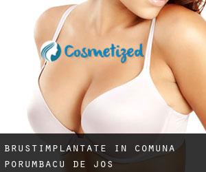 Brustimplantate in Comuna Porumbacu de Jos