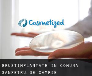 Brustimplantate in Comuna Sânpetru de Câmpie