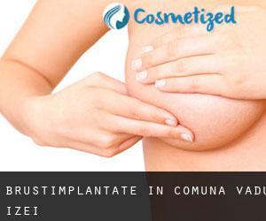 Brustimplantate in Comuna Vadu Izei