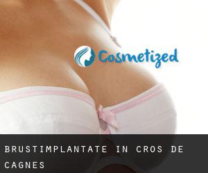 Brustimplantate in Cros-de-Cagnes