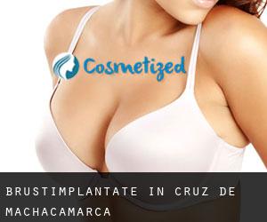 Brustimplantate in Cruz de Machacamarca