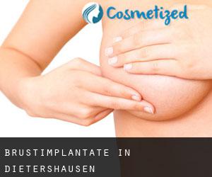 Brustimplantate in Dietershausen