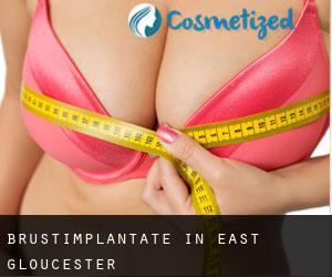 Brustimplantate in East Gloucester