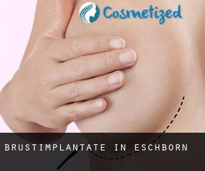 Brustimplantate in Eschborn