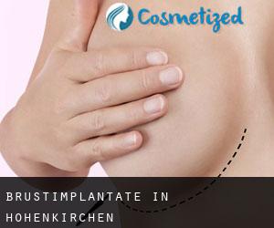 Brustimplantate in Hohenkirchen