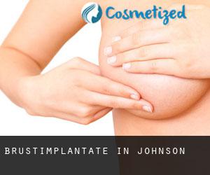 Brustimplantate in Johnson