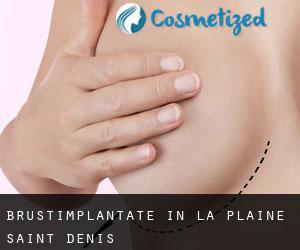 Brustimplantate in La Plaine-Saint-Denis