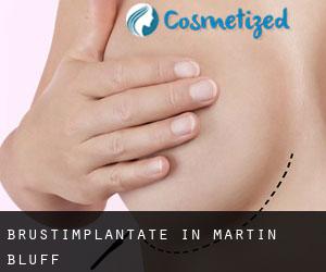 Brustimplantate in Martin Bluff