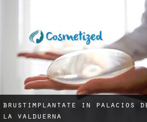 Brustimplantate in Palacios de la Valduerna