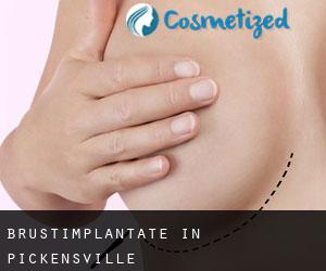 Brustimplantate in Pickensville