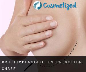 Brustimplantate in Princeton Chase