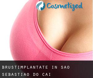 Brustimplantate in São Sebastião do Caí