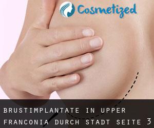 Brustimplantate in Upper Franconia durch stadt - Seite 3