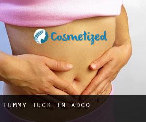 Tummy Tuck in Adco