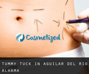 Tummy Tuck in Aguilar del Río Alhama
