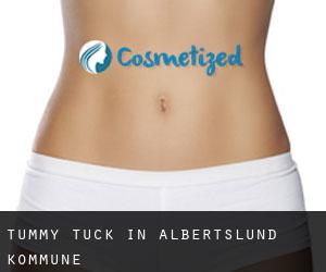 Tummy Tuck in Albertslund Kommune
