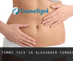 Tummy Tuck in Alexander Corner