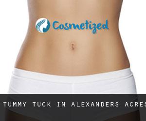 Tummy Tuck in Alexanders Acres