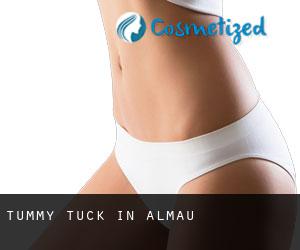 Tummy Tuck in Almau