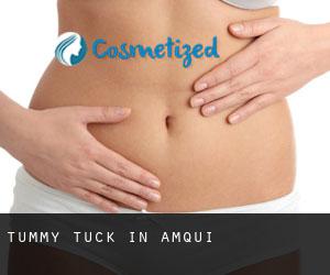 Tummy Tuck in Amqui