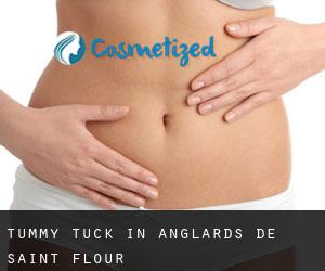 Tummy Tuck in Anglards-de-Saint-Flour
