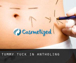 Tummy Tuck in Antholing