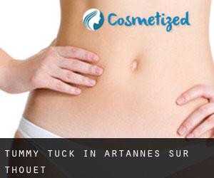 Tummy Tuck in Artannes-sur-Thouet