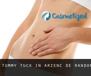Tummy Tuck in Arzenc-de-Randon