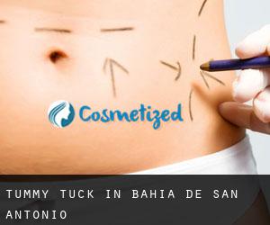 Tummy Tuck in Bahia de San Antonio