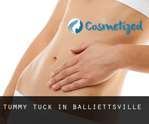 Tummy Tuck in Balliettsville