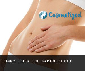 Tummy Tuck in Bamboeshoek