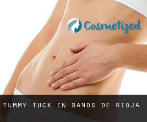 Tummy Tuck in Baños de Rioja