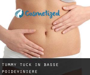 Tummy Tuck in Basse Poidevinière