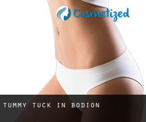 Tummy Tuck in Bodion