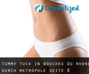 Tummy Tuck in Bouches-du-Rhône durch metropole - Seite 8