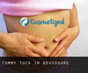 Tummy Tuck in Boussoure