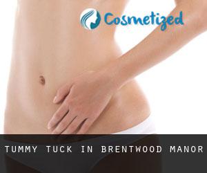 Tummy Tuck in Brentwood Manor
