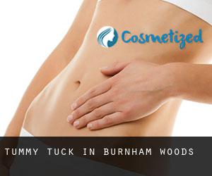 Tummy Tuck in Burnham Woods