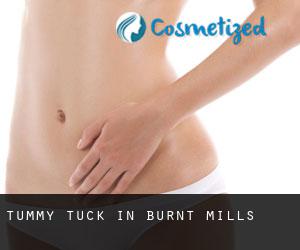 Tummy Tuck in Burnt Mills