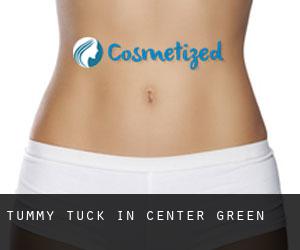 Tummy Tuck in Center Green