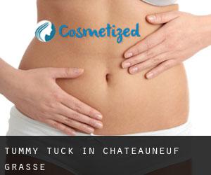 Tummy Tuck in Châteauneuf-Grasse