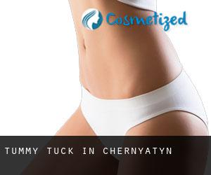 Tummy Tuck in Chernyatyn