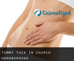 Tummy Tuck in Church Handborough