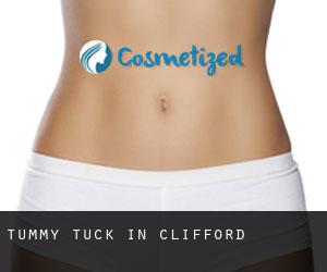 Tummy Tuck in Clifford